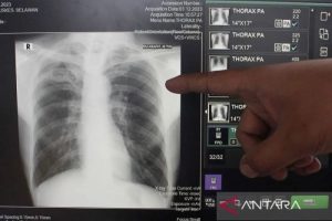 politica news 6 Warga Kwitang Diserbu Petugas Ada Apa Ini