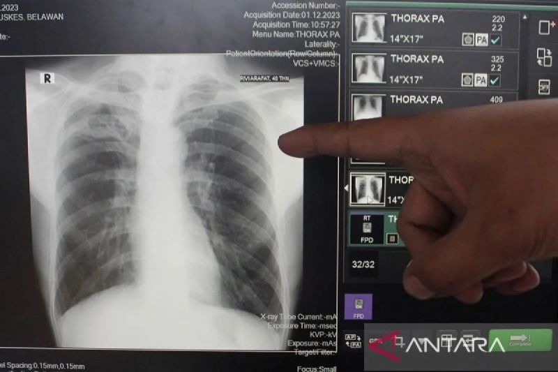 Warga Kwitang Diserbu Petugas Ada Apa Ini
